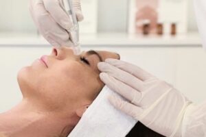 Mesoterapia despigmentante en Salamanca.